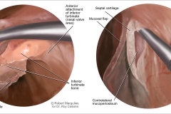 ENT Dissection Guide