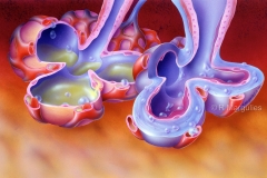 Adult Respiratory Distress Syndrome